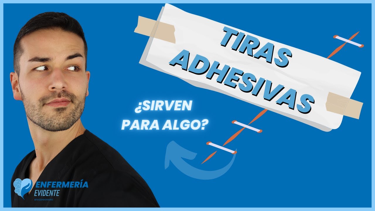 puntos de aproximación en la cara