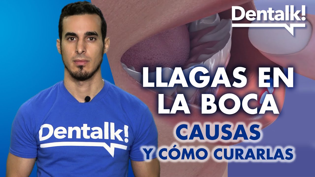 que medicamento es bueno para las aftas en la boca