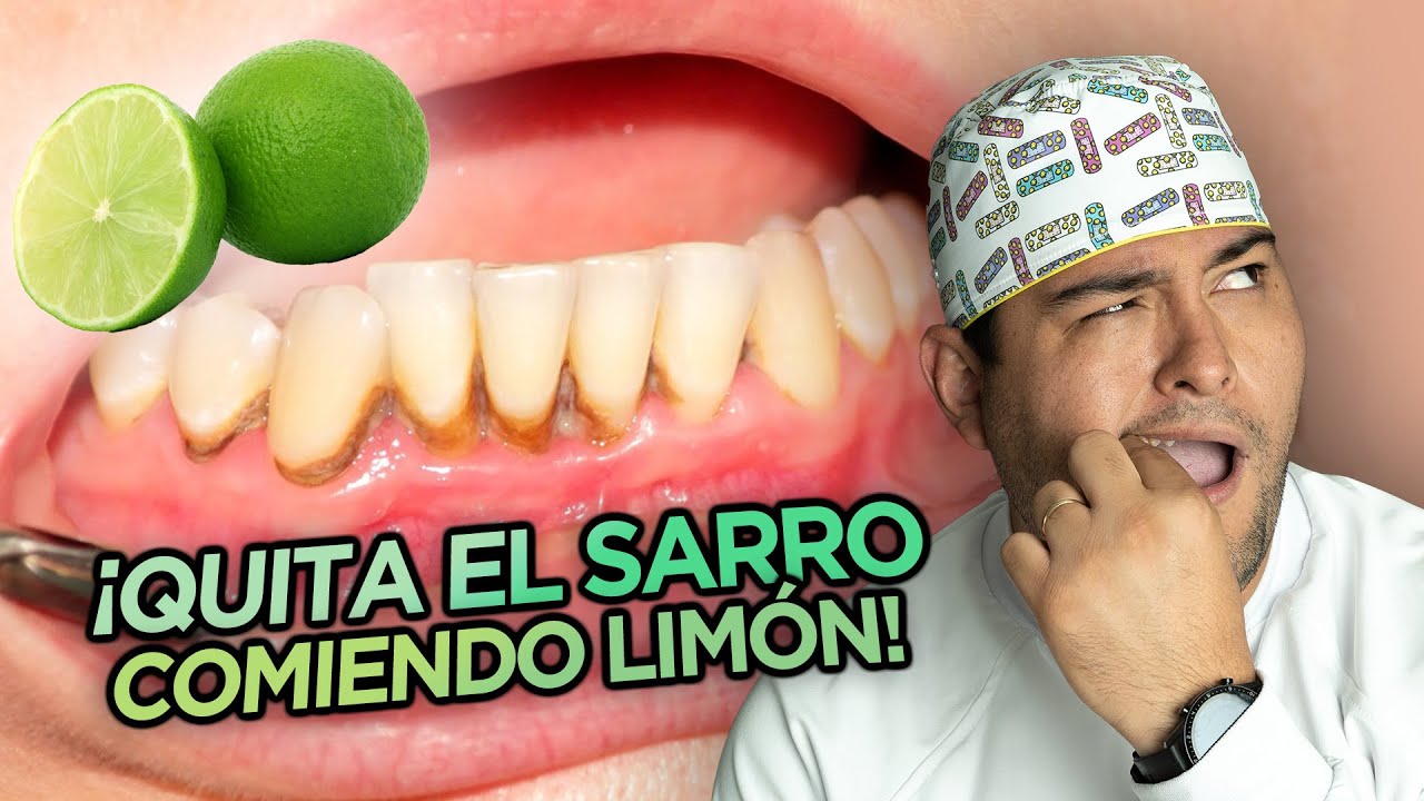 remedios para quitar el sarro de los dientes