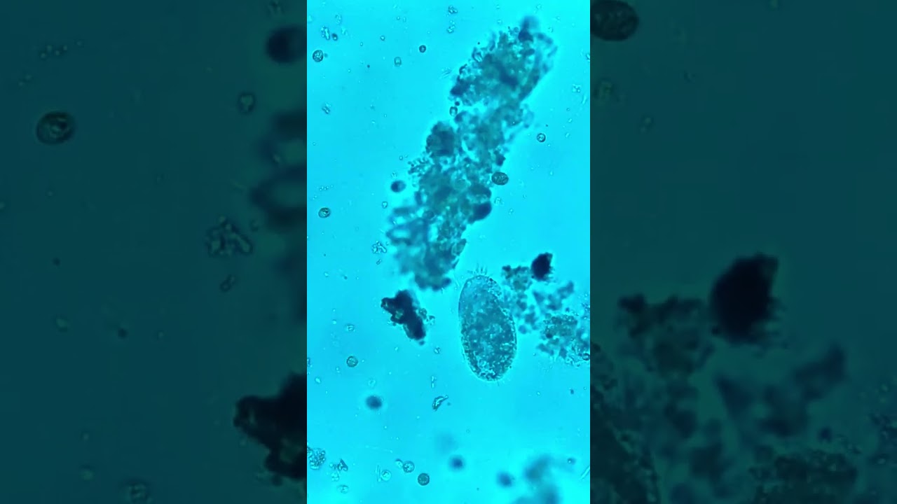 seres vivos que solo se pueden ver con microscopio
